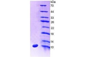 SDS-PAGE analysis of Human SLC30A8 Protein. (SLC30A8 Protein)