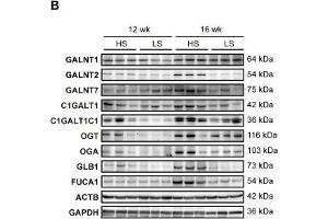 Upregulation of glycogene expression in the LV of DS hypertensive rats. (GLB1 Antikörper)