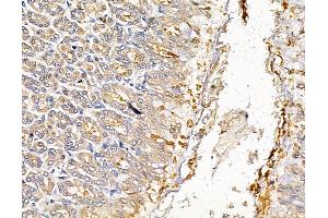 ABIN7095038 and ABIN7099094 at 1/100 staining rat stomach tissue by IHC-P. (GUCY2C Antikörper)