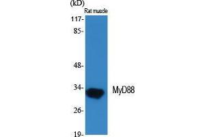 Western Blot (WB) analysis of specific cells using MyD88 Polyclonal Antibody. (MYD88 Antikörper  (Internal Region))