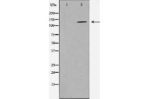 Western blot analysis of HDAC5 expression in NIH-3T3 whole cell lysates,The lane on the left is treated with the antigen-specific peptide. (HDAC5 Antikörper  (Internal Region))