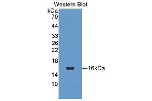 Western blot analysis of the recombinant protein. (PIGR Antikörper  (AA 135-237))
