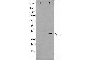 Western blot analysis on HeLa cell lysate using GFRA4 Antibody，The lane on the left is treated with the antigen-specific peptide. (GFRA4 Antikörper  (Internal Region))