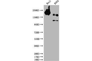 Western Blot Positive WB detected in: Raji whole cell lysate, K562 whole cell lysate All lanes: INPP5D antibody at 1:1500 Secondary Goat polyclonal to rabbit IgG at 1/50000 dilution Predicted band size: 134, 110 kDa Observed band size: 145 kDa (Rekombinanter INPP5D Antikörper)
