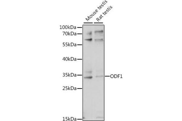 ODF1 Antikörper  (AA 80-180)