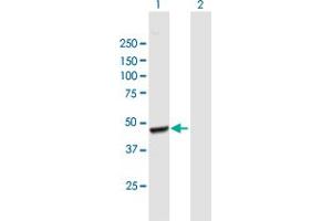 Western Blot analysis of AACS expression in transfected 293T cell line by AACS MaxPab polyclonal antibody. (AACS Antikörper  (AA 1-410))