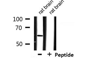 Western blot analysis of extracts from rat brain, using CSTF2 Antibody. (CSTF2 Antikörper  (N-Term))