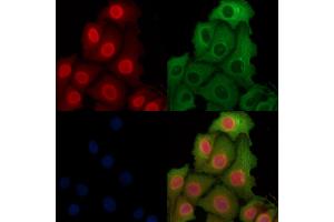 ABIN6262398 and ABIN6269012 staining Hela cells by IF/ICC. (HSP70 Antikörper  (C-Term))