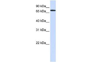 GALNT6 antibody used at 1 ug/ml to detect target protein. (GALNT6 Antikörper)