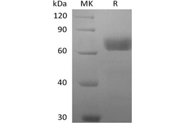 BTN2A2 Protein (Biotin)