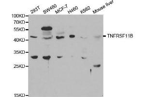 Western blot analysis of extracts of various cell lines, using TNFRSF11B antibody. (Osteoprotegerin Antikörper  (AA 22-280))