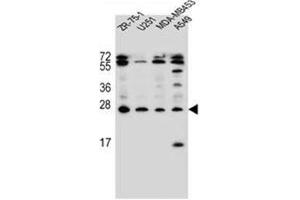 Western blot analysis of Endothelin-1 Antibody (C-term) in ZR-75-1, U251, MDA-MB453, A549 cell line lysates (35ug/lane). (Endothelin 1 Antikörper  (C-Term))