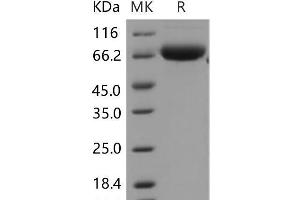 Western Blotting (WB) image for ADP-Ribosyltransferase 4 (Dombrock Blood Group) (ART4) protein (Fc Tag) (ABIN7320049) (ART4 Protein (Fc Tag))