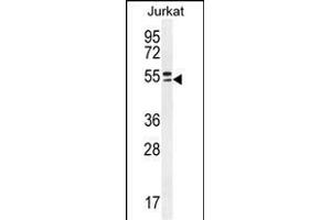 TRIM59 Antibody (N-term) (ABIN655580 and ABIN2845072) western blot analysis in Jurkat cell line lysates (35 μg/lane).