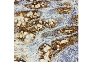 Anti-beta Catenin antibody, IHC(F) IHC(F): Rat Intestine Tissue (CTNNB1 Antikörper  (C-Term))