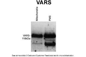 WB Suggested Anti-VARS Antibody Titration: 1 ug/mlPositive Control: Wildtype Neurospora crassa (VARS Antikörper  (Middle Region))