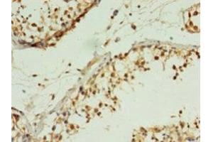 Immunohistochemistry of paraffin-embedded human testis tissue using ABIN7165811 at dilution of 1:100 (MIS12 Antikörper  (AA 1-305))