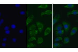 Detection of AMH in Human Hela cell using Monoclonal Antibody to Anti-Mullerian Hormone (AMH) (AMH Antikörper  (AA 19-560))
