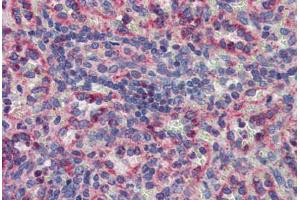 Spleen, Human: Formalin-Fixed, Paraffin-Embedded (FFPE) (MKNK2 Antikörper  (AA 36-85))