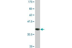 Western Blotting (WB) image for anti-LIM Domain Kinase 1 (LIMK1) (AA 548-647) antibody (ABIN517518)