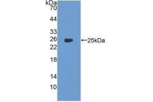 Detection of Recombinant PTGS2, Human using Polyclonal Antibody to Cyclooxygenase-2 (COX 2) (COX2 Antikörper  (AA 418-589))