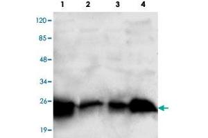 Western blot analysis of RAB2A monoclonal antibody  at 1:1000 dilution. (RAB2A Antikörper  (C-Term))