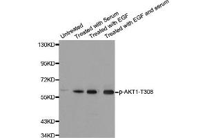 Western Blotting (WB) image for anti-V-Akt Murine Thymoma Viral Oncogene Homolog 1 (AKT1) (pThr308) antibody (ABIN1869972) (AKT1 Antikörper  (pThr308))
