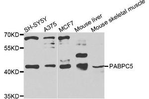 Western blot analysis of extracts of various cells, using PABPC5 antibody. (PABPC5 Antikörper)