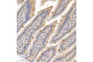 Immunohistochemistry of paraffin embedded mouse small intestine using PTPN3 (ABIN7075298) at dilution of 1:700 (300x lens) (PTPN3 Antikörper)