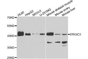 Western blot analysis of extracts of various cell lines, using ERGIC2 antibody. (ERGIC2 Antikörper  (AA 55-310))