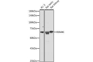 Western blot analysis of extracts of various cell lines, using RBM46 antibody (ABIN7270086) at 1:1000 dilution. (RBM46 Antikörper  (AA 1-140))