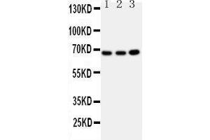 Western Blotting (WB) image for anti-Guanylate Binding Protein 1, Interferon-Inducible (GBP1) (AA 566-589), (C-Term) antibody (ABIN3042677) (GBP1 Antikörper  (C-Term))