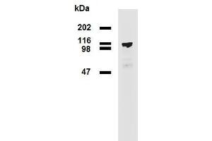 Western blotting analysis (reducing conditions) of PDE8a in HEK293T/17-PDE8a transfectants using mouse monoclonal antibody EM-52 . (PDE8A Antikörper)