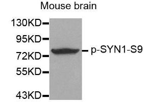 Western blot analysis of extracts from mouse Brain tissue using Phospho-SYN1-S9 antibody (ABIN2987713). (SYN1 Antikörper  (pSer9))