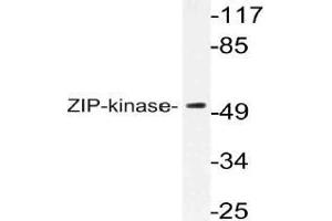 Western blot (WB) analysis of ZIP-kinase antibody in extracts from HuvEc cells.