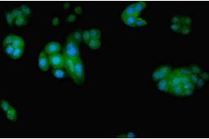 Immunofluorescent analysis of PC-3 cells using ABIN7152209 at dilution of 1:100 and Alexa Fluor 488-congugated AffiniPure Goat Anti-Rabbit IgG(H+L) (EIF5 Antikörper  (AA 1-431))