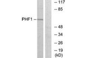 Western blot analysis of extracts from HeLa cells, using PHF1 Antibody. (PHF1 Antikörper  (AA 345-394))