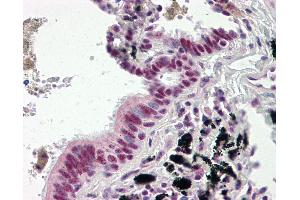 Immunohistochemistry (IHC) image for anti-DnaJ (Hsp40) Homolog, Subfamily C, Member 3 (DNAJC3) (AA 270-462) antibody (ABIN467547)
