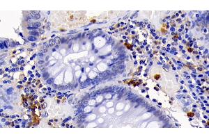 Immunohistochemistry (IHC) image for anti-Caspase 3 (CASP3) (AA 29-175) antibody (ABIN7428803)