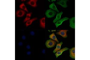 ABIN6260159 and ABIN6278363 staining Hela cells by IF/ICC.