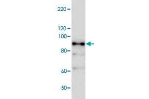 Western blot analysis of bacterial lysate of MBP-fused antigen partial protein with Nbr1 polyclonal antibody . (NBR1 Antikörper)