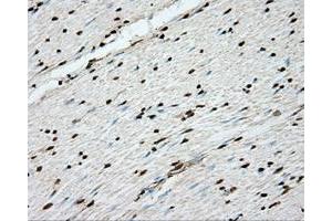 Immunohistochemical staining of paraffin-embedded Kidney tissue using anti-ERCC1 mouse monoclonal antibody. (ERCC1 Antikörper)