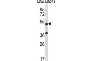 Western Blotting (WB) image for anti-Tripartite Motif Containing 10 (TRIM10) antibody (ABIN2996897) (TRIM10 Antikörper)