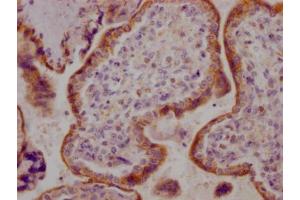 Immunohistochemistry (IHC) image for anti-Activin A Receptor, Type IIB (ACVR2B) antibody (ABIN7127321)