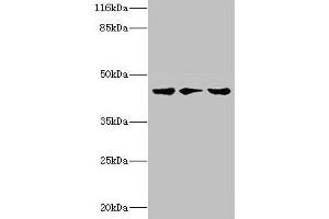 Western blot All lanes: PSKH2 antibody at 2 μg/mL Lane 1: Hela whole cell lysate Lane 2: Mouse heart tissue Lane 3: Rat gonad tissue Secondary Goat polyclonal to rabbit IgG at 1/10000 dilution Predicted band size: 44 kDa Observed band size: 44 kDa (PSKH2 Antikörper  (AA 63-320))