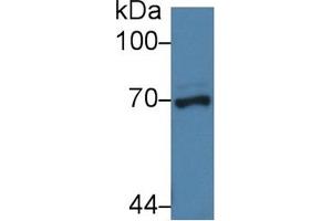 Detection of NUP62 in Porcine Liver lysate using Polyclonal Antibody to Nucleoporin 62 (NUP62) (NUP62 Antikörper  (AA 186-432))