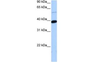 Western Blotting (WB) image for anti-Zinc Finger Protein 562 (ZNF562) antibody (ABIN2463443) (ZNF562 Antikörper)