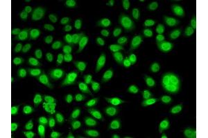 Immunofluorescence analysis of U2OS cells using PPL antibody (ABIN5974178). (PPL Antikörper)