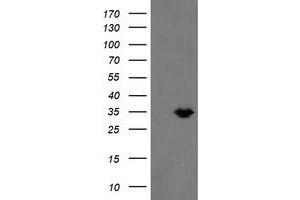 Image no. 1 for anti-Methylmalonic Aciduria (Cobalamin Deficiency) CblC Type, with Homocystinuria (MMACHC) antibody (ABIN1499515)