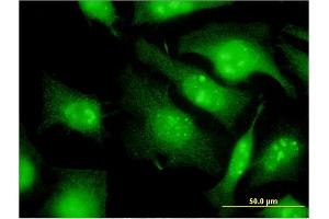 Immunofluorescence of monoclonal antibody to EIF2S3 on HeLa cell. (EIF2S3 Antikörper  (AA 383-472))